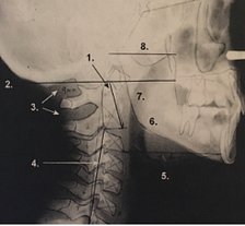 Human skull and spine