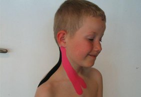 Kinesio Tape on a childs neck
