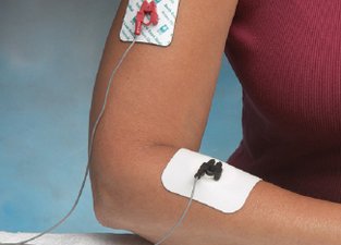 Iontophoresis on arm