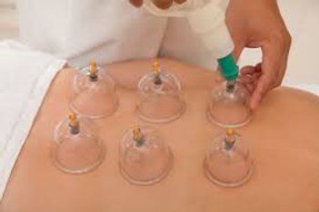 Cupping method used on the back