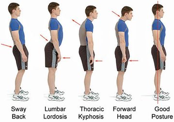 Examples of standing postures